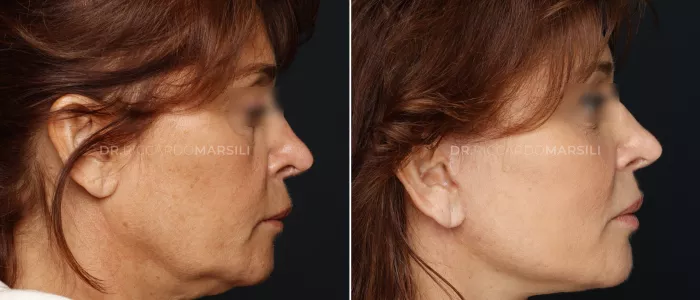 Lifting-Deep-plane-Paris Lifting Deep plane Paris