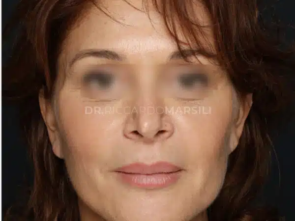 Lifting Paris Deep Plane 2048x1024 1