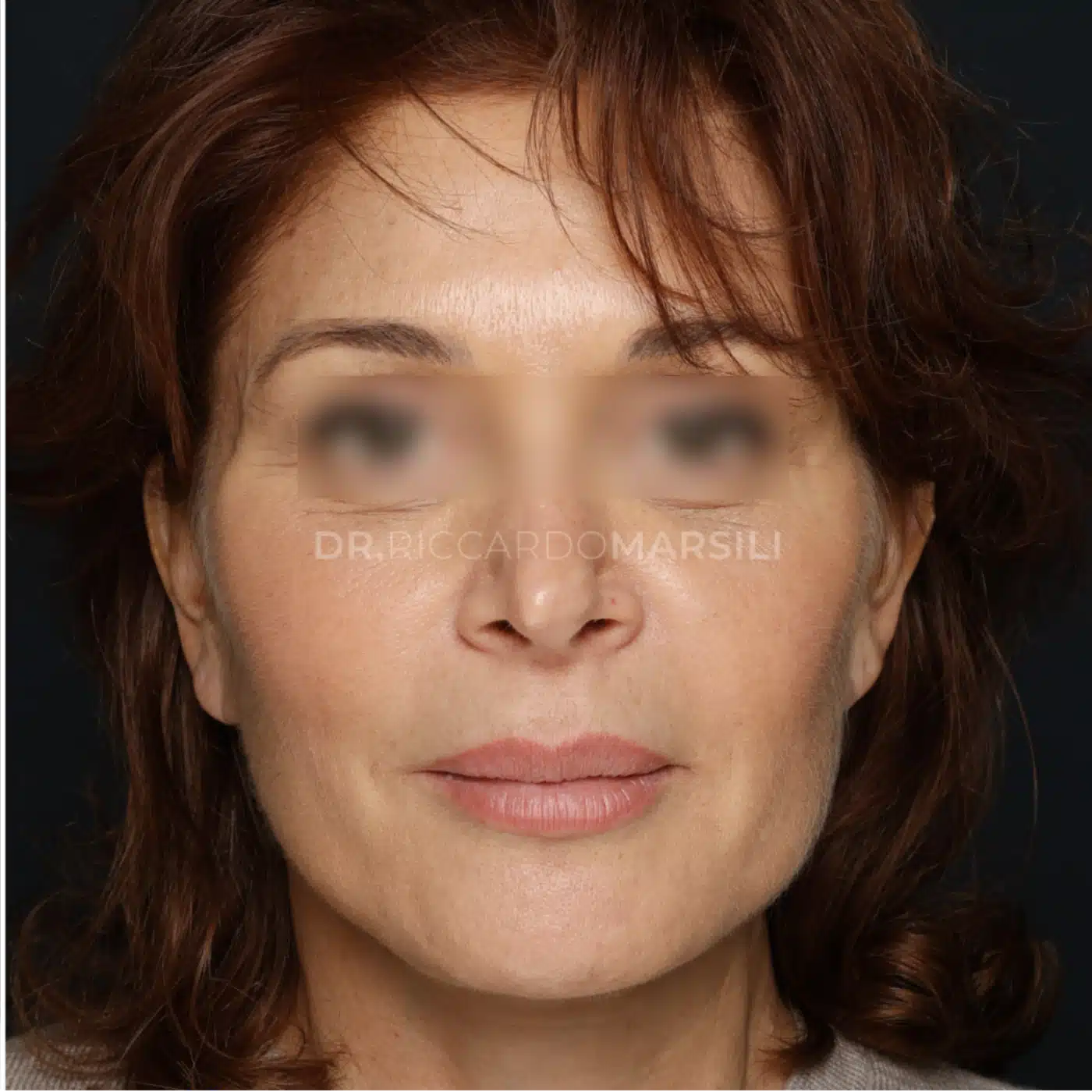 Lifting Paris Deep Plane 2048x1024 1